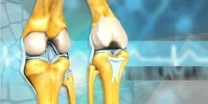 Visual representation of the anatomic or bone structure of two knees